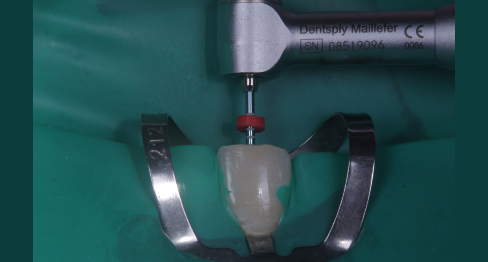 Resultados digitales